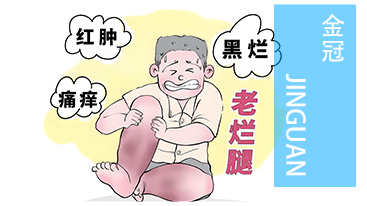 远离老烂腿:日常呵护下肢的 4 个关键要点